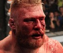 Brock Lesnar is a beaten man