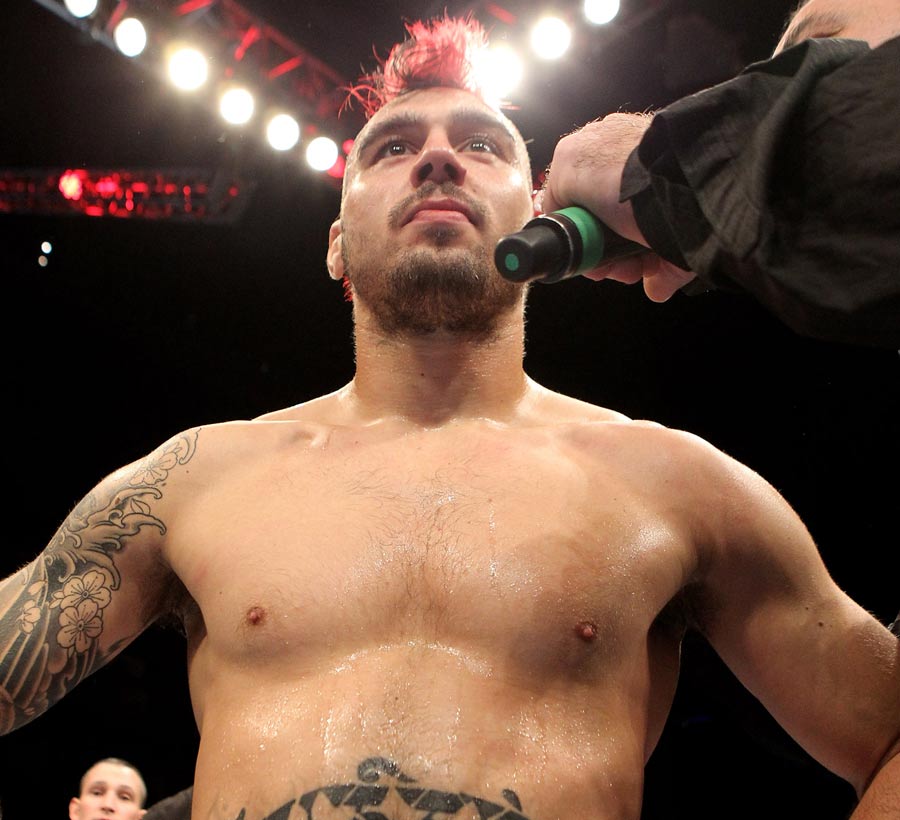 Dan Hardy is interviewed after being knocked out by Carlos Condit