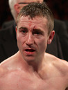 Paul McCloskey shows off the cut that saw his fight stopped