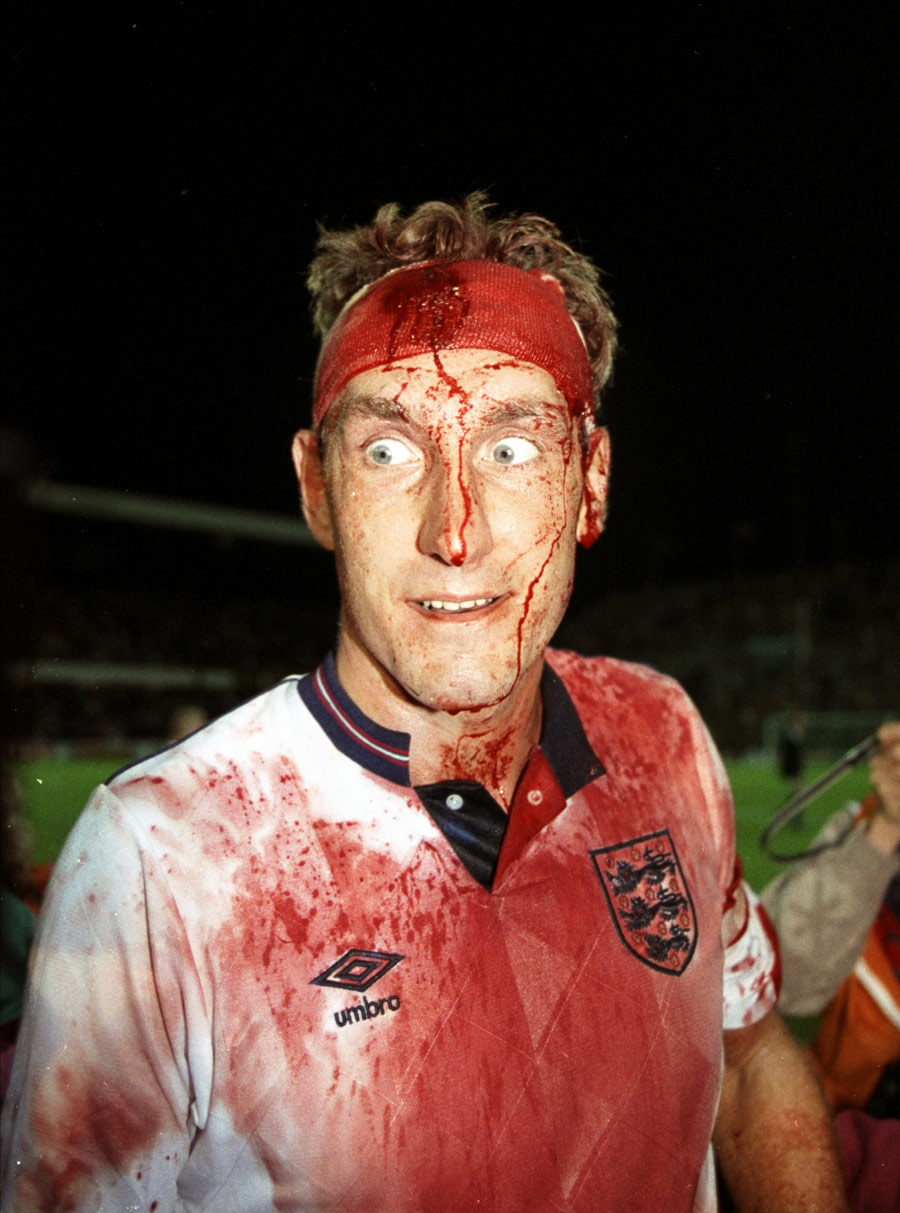 Terry Butcher is left bloodied at the end of the game