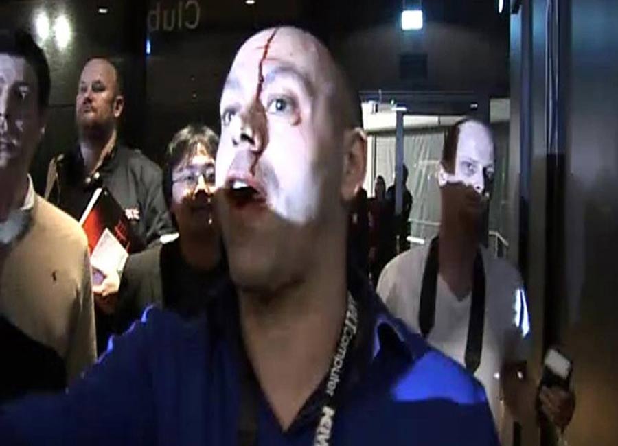 A video grab of Adam Booth, who was bloodied when Dereck Chisora and David Haye clashed