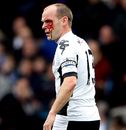 Danny Murphy is bloodied after a collision