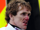 Tony McCoy is bloodied after taking a fall from Mr Watson