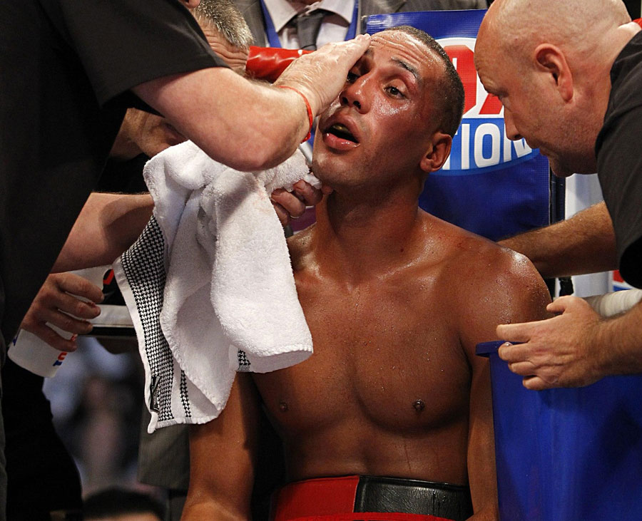 James DeGale receives treatment to a cut above his eye