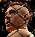 Dan Hardy looks weary after facing Georges St-Pierre