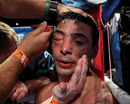 Lucas Matthysse has his eye worked on in his corner at the end of the 11th round