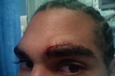 David Haye shows his cut which caused his fight with Tyson Fury to be postponed